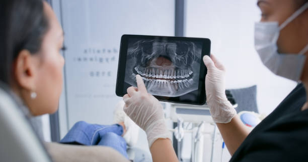 Licensed Tooth Extraction service in Ogdensburg, NY - Smile Center Dentistry